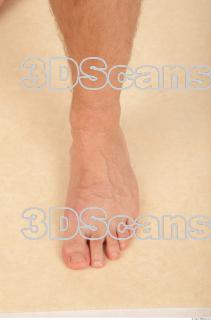 Photo reference of foot 0002